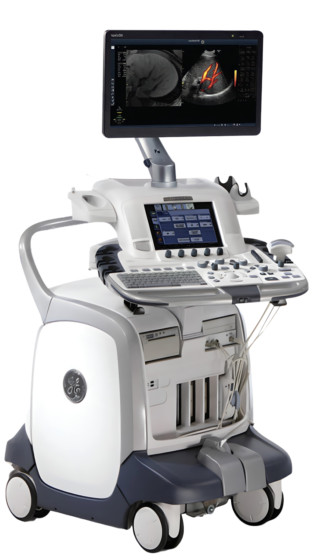 GE Logiq E9 Ultrasound Machine