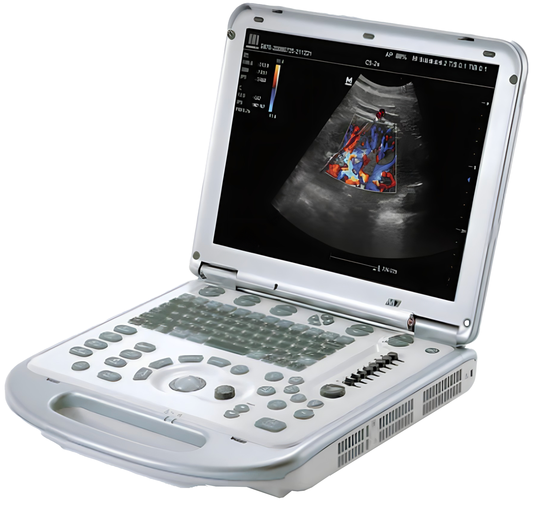 Mindray M7 Portable Ultrasound Machine