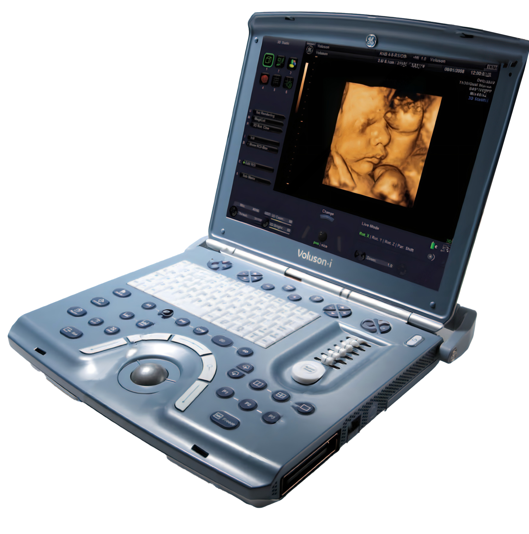 GE Voluson I Portable Ultrasound Machine