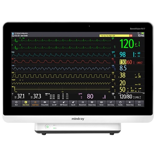 Mindray BeneVision N17 Patient Monitor